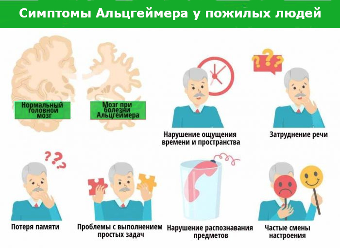 Симптомы и признаки Альцгеймера у пожилых людей